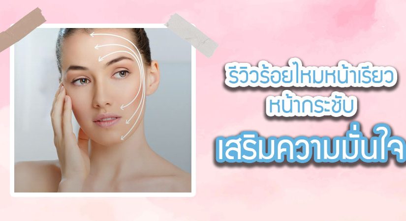 ร้อยไหมหน้าเรียวรีวิว ช่วยให้หน้ากระชับ เสริมความมั่นใจ