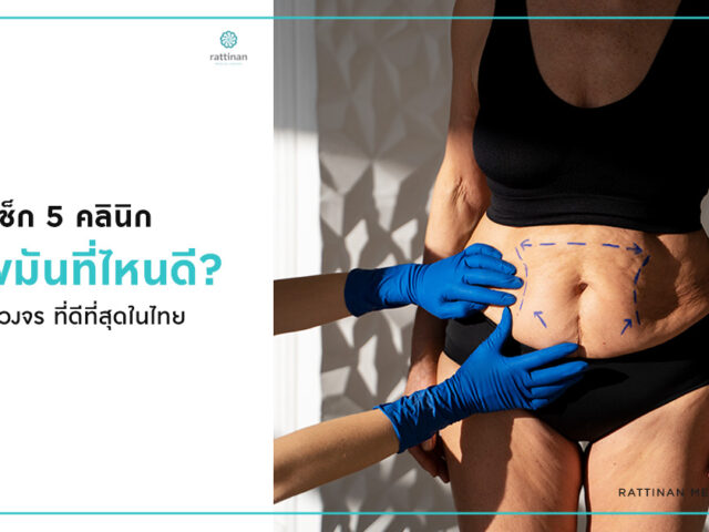 เช็ก 5 คลินิกดูดไขมันที่ไหนดี ปลอดภัย ครบวงจร ที่ดีที่สุดในไทย